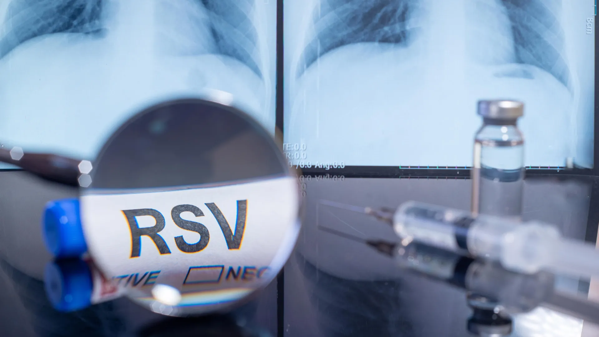 Maternal RSV Vaccination Dramatically Reduces Infant Hospitalizations, UK Research Confirms Real-World Efficacy