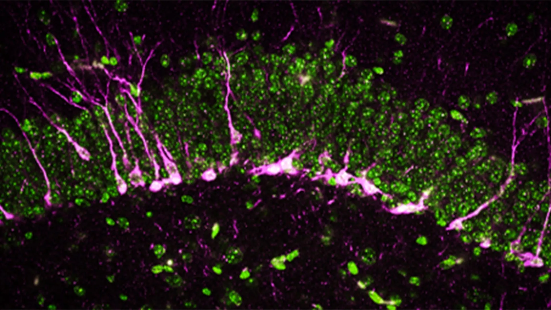 A New Gaseous Messenger in the Brain Emerges as a Potential Target for Alzheimer’s Disease Treatment