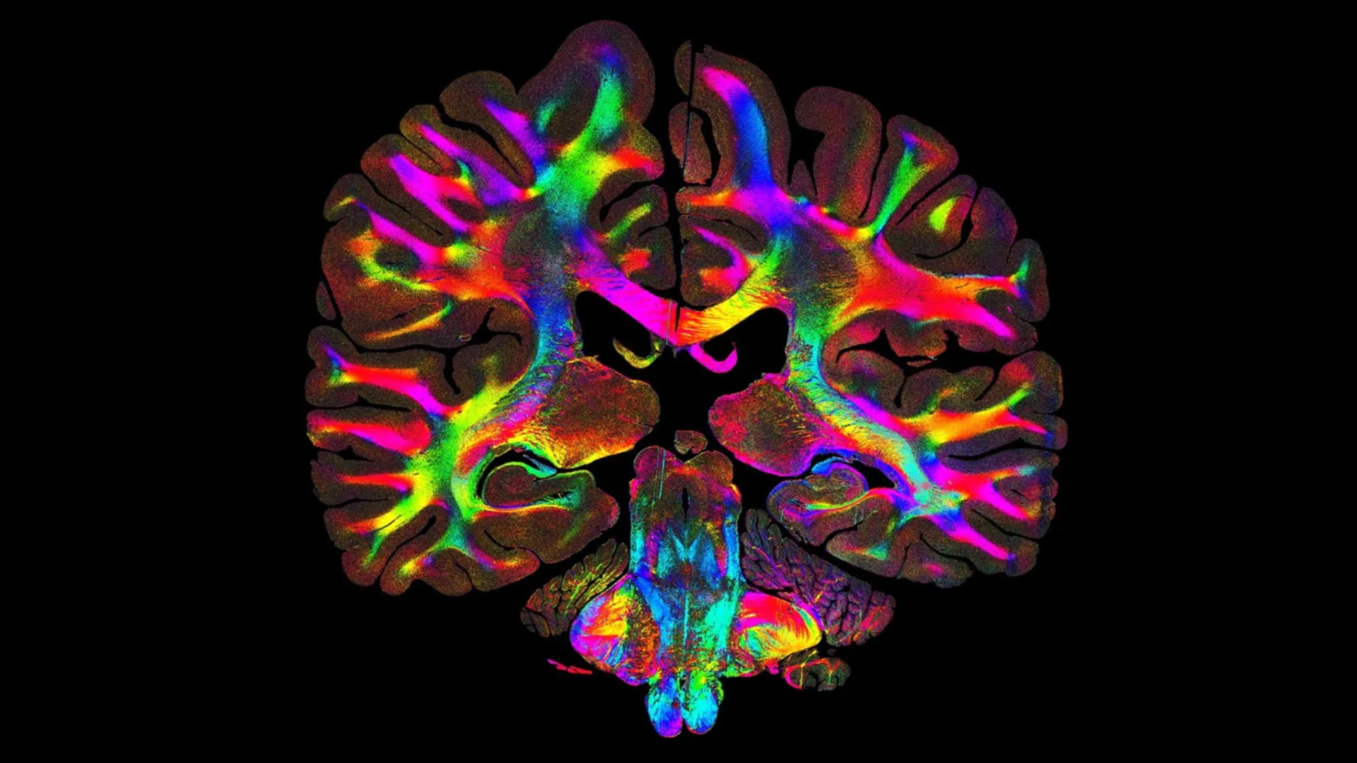 A Breakthrough in Biomedical Imaging Reveals Hidden Microscopic Fiber Networks, Revolutionizing Disease Study