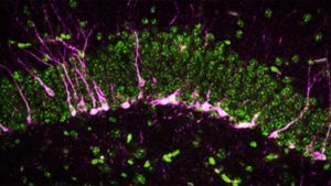A Promising New Avenue for Alzheimer’s Treatment Emerges from Hydrogen Sulfide Research