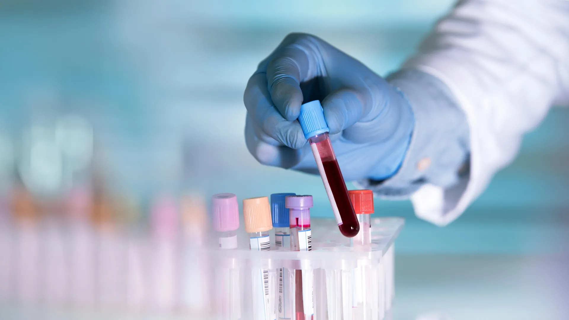 Blood Tests Tracking White Blood Cell Aging Show Promise for Identifying Depression Through Emotional and Cognitive Symptoms