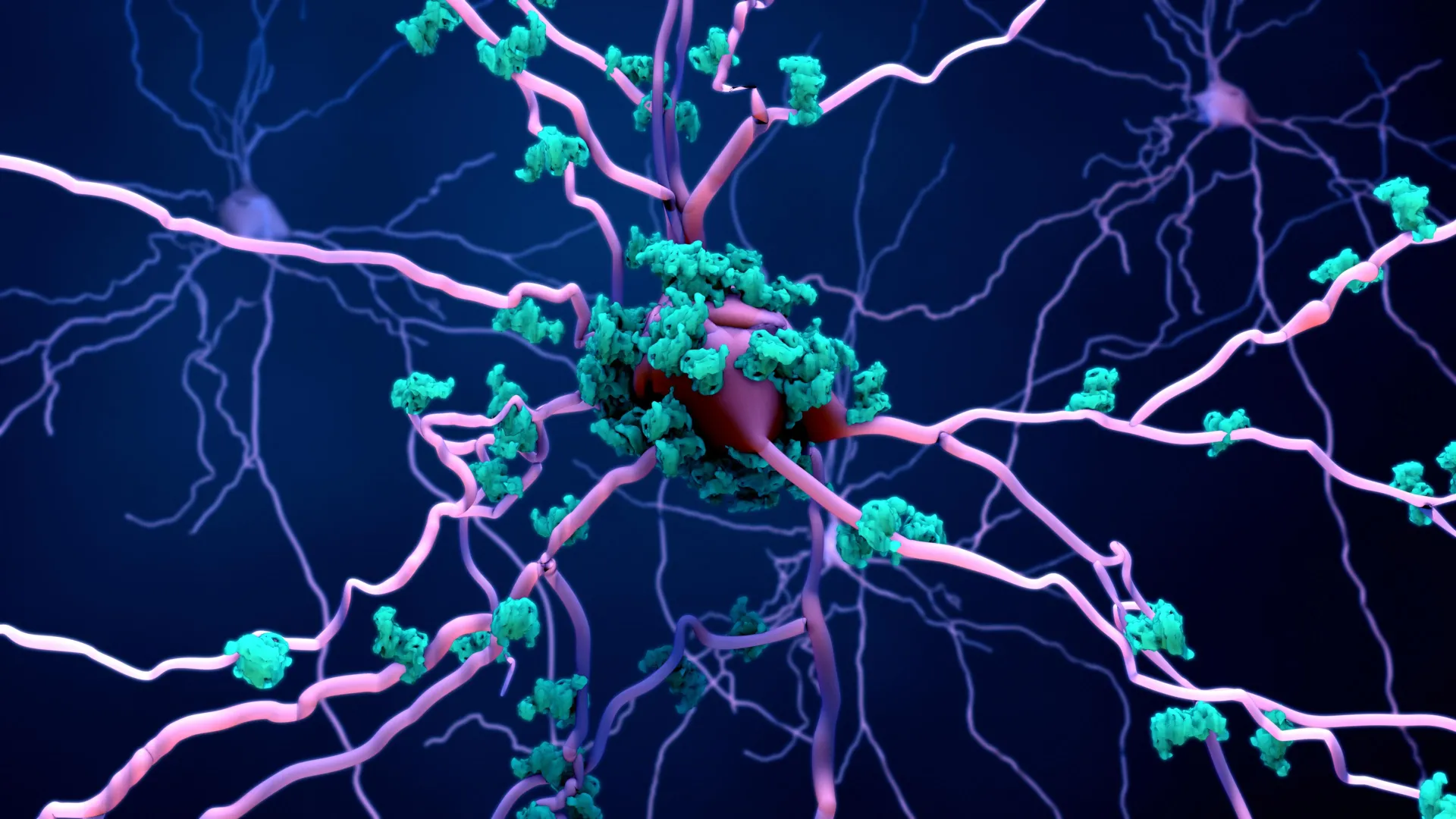 A Novel Pathway of Brain Cell Death, Karyoptosis, Identified as a Key Driver in Alzheimer’s Disease and Frontotemporal Dementia
