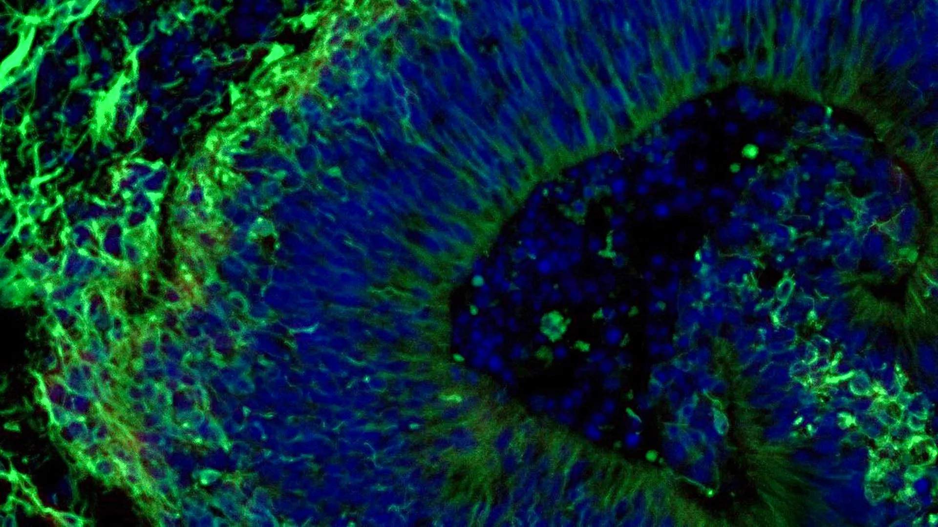 Johns Hopkins Researchers Uncover Promising New Avenues for Alzheimer’s Treatment Personalization Through Brain Organoid Studies