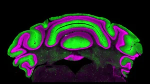 Rethinking Cerebellar Function: Virginia Tech Study Challenges Long-Held Assumptions in Neurological Research