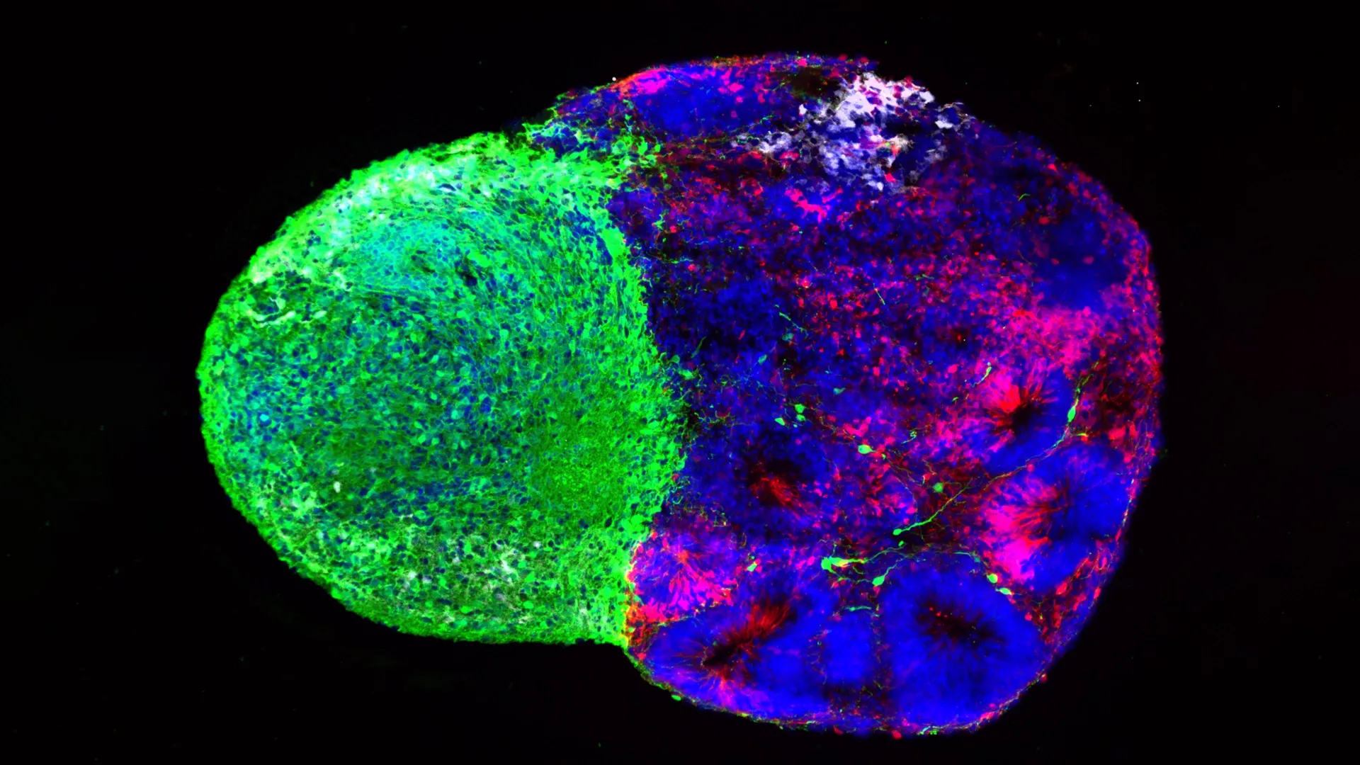 Cellular Architects of the Human Mind: Groundbreaking UCLA Studies Reveal How Metabolic Shifts and Early Neural Signals Shape the Cerebral Cortex