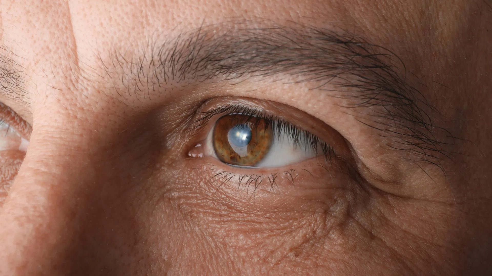 Cialis linked to higher glaucoma risk in large study