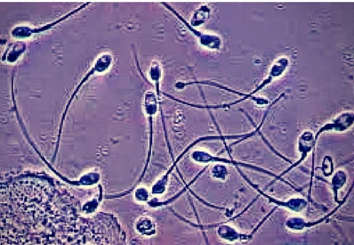 The Rise of At-Home Male Fertility Testing: Digital Innovations, Environmental Factors, and Clinical Implications