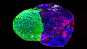 Unlocking the Blueprint of Human Intelligence: Groundbreaking UCLA Studies Reveal How Master Stem Cells Build the Cerebral Cortex